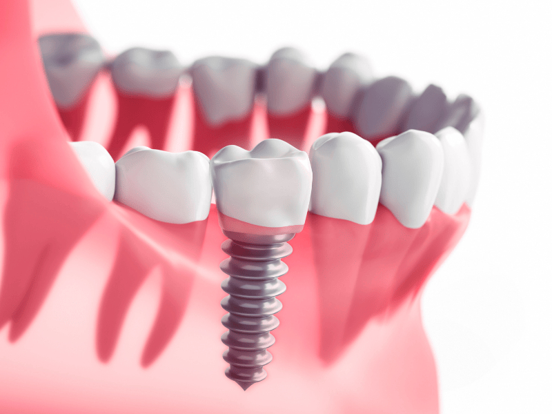 Prosthodontics