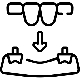 Dental Bridges