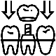 Dental Crowns