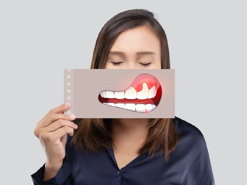 Gum & Periodontal Care