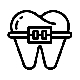 Metal Braces