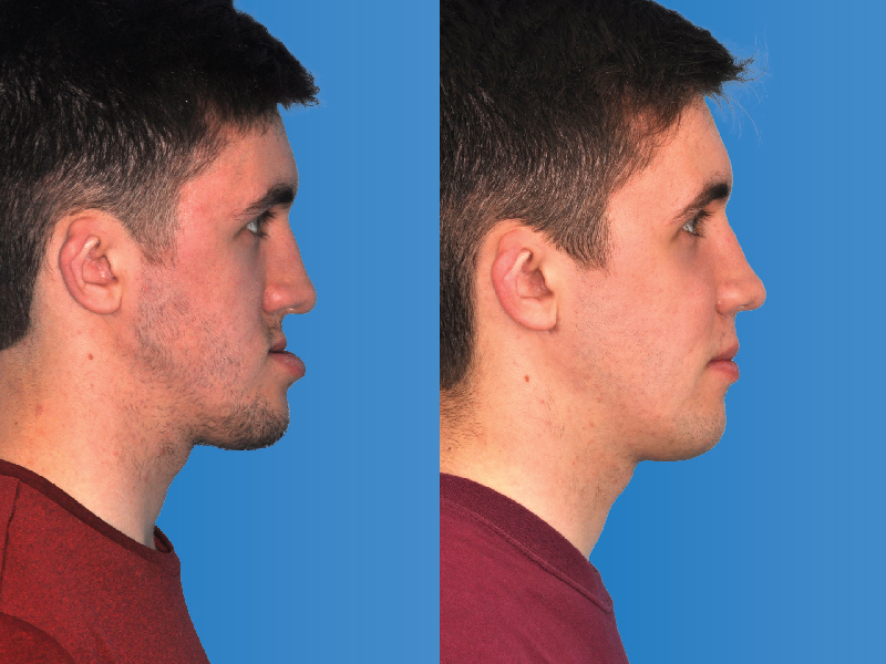 Oral & Maxillofacial Surgery